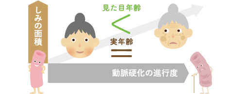 しみの面積と動脈硬化の関係